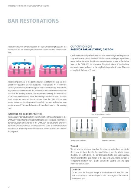 Hybrid Restorations with the CAMLOG Implant System (PDF