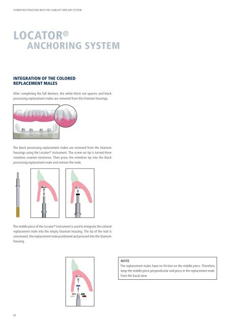 Hybrid Restorations with the CAMLOG Implant System (PDF
