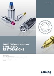 CONELOG® Implant System Prosthetic Restorations - Camlog