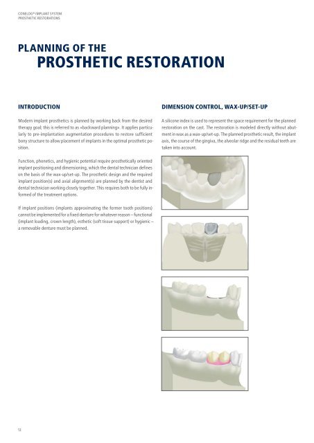 CONELOG® Implant System Prosthetic Restorations - Camlog