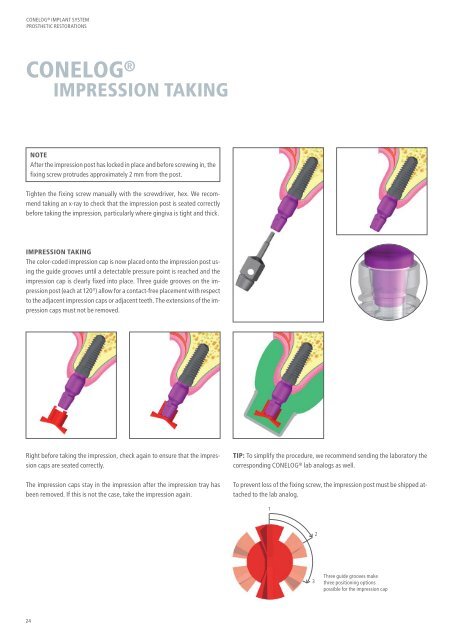 CONELOG® Implant System Prosthetic Restorations - Camlog