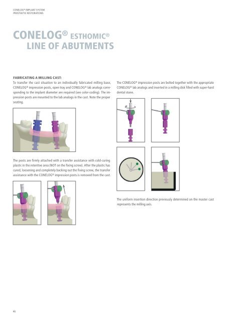 CONELOG® Implant System Prosthetic Restorations - Camlog