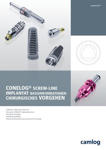 CONELOG® SCREW-LINE Implantat Basisinformationen ... - Camlog