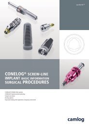 CONELOG® SURGICAL PROCEDURES - Camlog