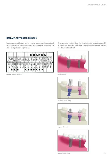 CONELOG® SURGICAL PROCEDURES - Camlog