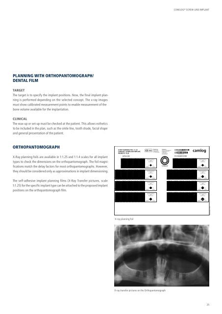 CONELOG® SURGICAL PROCEDURES - Camlog