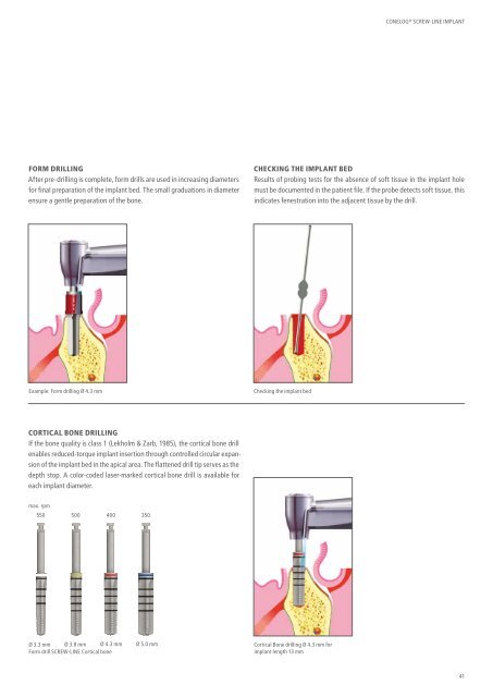 CONELOG® SURGICAL PROCEDURES - Camlog