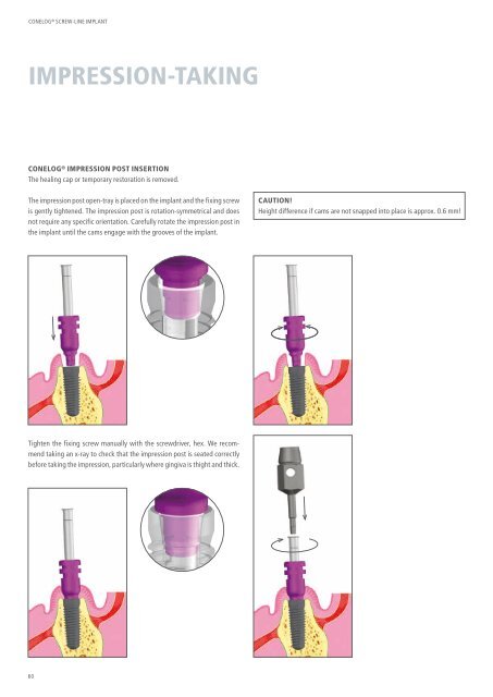 CONELOG® SURGICAL PROCEDURES - Camlog