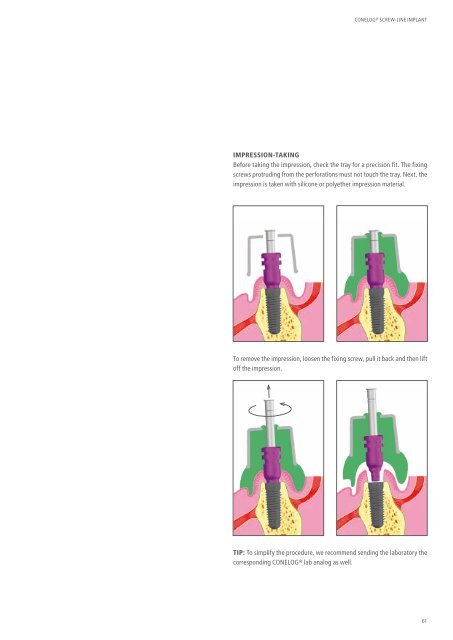 CONELOG® SURGICAL PROCEDURES - Camlog