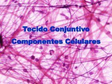 Tecido Conjuntivo Componentes Celulares