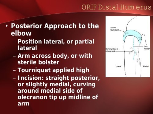 Distal Humeral Fractures - Dr. Kwee (Aug 22, 2006