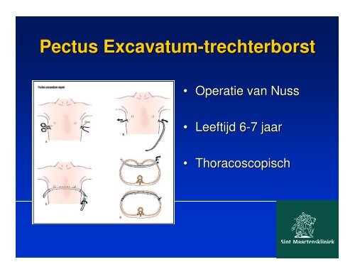 vallen en opstaan,kinderorthopedie