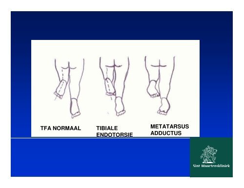 vallen en opstaan,kinderorthopedie