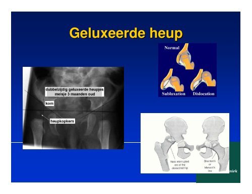 vallen en opstaan,kinderorthopedie