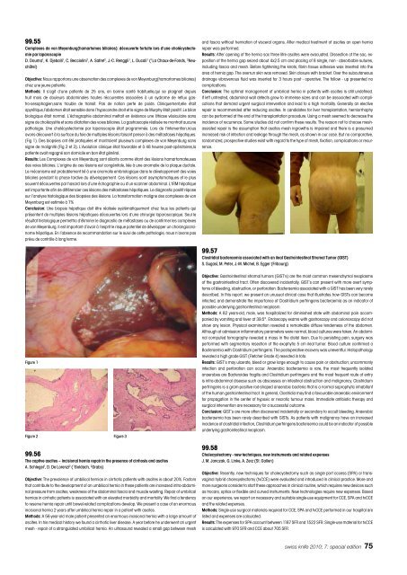 Anorectal Manometry in 3D NEW! - Swiss-knife.org