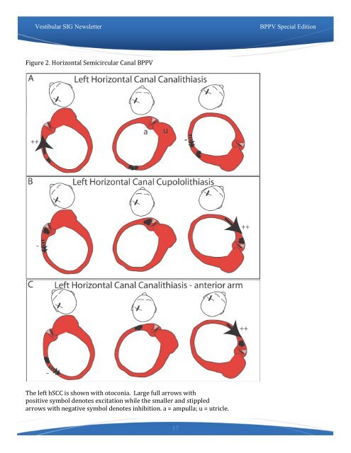 Practice Guidelines for BPPV - Neurology Section