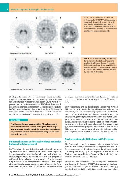 DatScan, IBZM und Hirndurchblutungsszintigraphie DMW 2008