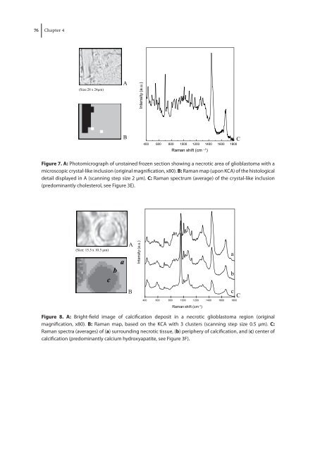 Towards clinico-pathological application of Raman spectroscopy