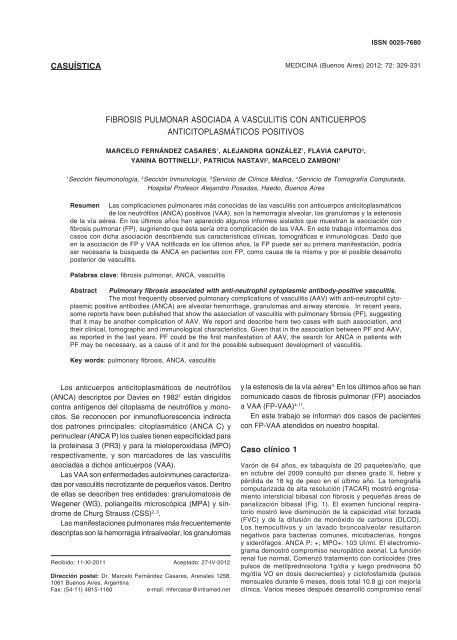 vasculitis pulmonar