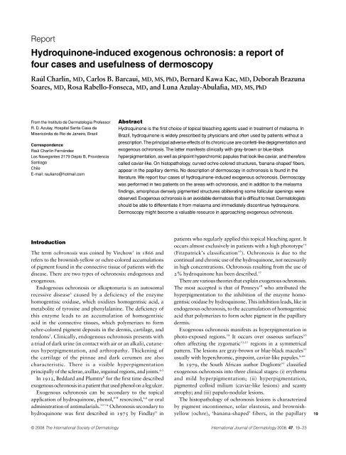 Hydroquinone-induced exogenous ochronosis - instituto de ...