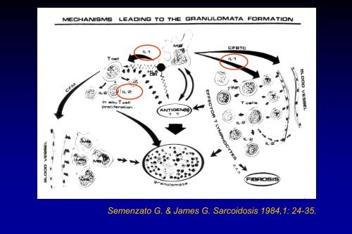 Sarcoidosis - Cleveland Clinic Center for Continuing Education