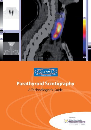 Parathyroid Scintigraphy - European Association of Nuclear Medicine