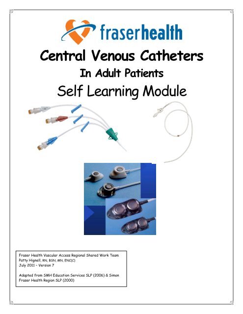 Central Venous Catheter Locations