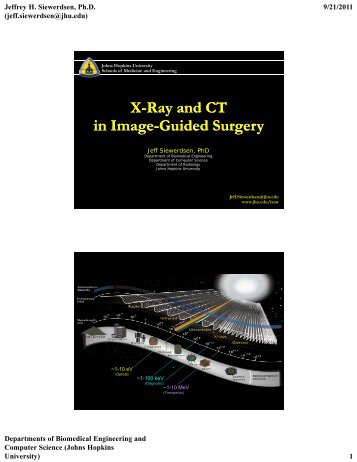 X R d CT X R d CT X-Ray and CT in Image-Guided Surgery X-Ray ...