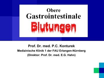 Prävention der Post-ERCP Pankreatitis: Sekretin, NSAR ... - Medizin 1