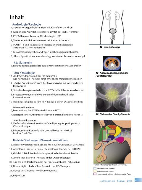 Uro-Onkologie - Andrologen.info