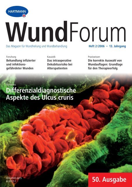 Heft 2/2006 – 13. Jahrgang WundForum - Hartmann