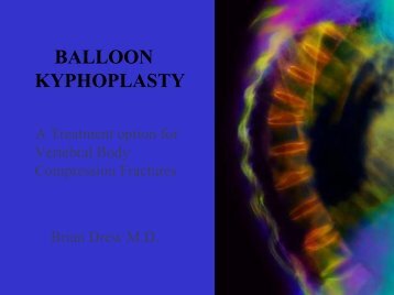 Balloon Kyphoplasty for Vertebral Compression Fractures