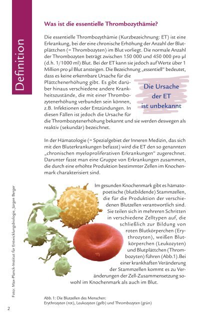 Die essentielle Thrombozythämie (ET) - Shire Deutschland GmbH