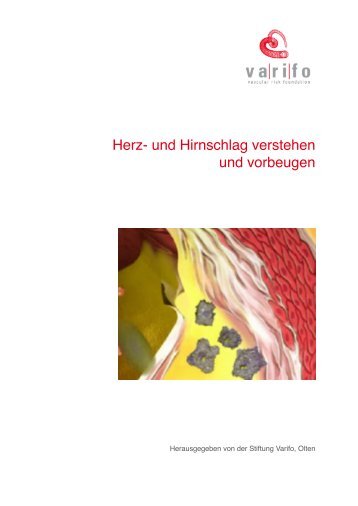 Herz- und Hirnschlag verstehen und vorbeugen - Gesundheitscheck ...