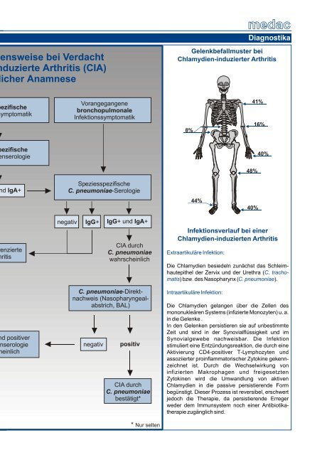 Chlamydien-induzierte Arthritis