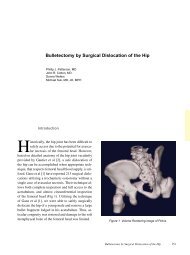 Bulletectomy by Surgical Dislocation of the Hip - TeraRecon