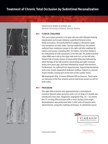 Treatment of Occlusion by Subintimal Recanalization ... - Gore Medical