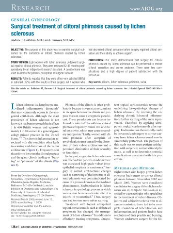 Surgical treatment of clitoral phimosis caused by lichen