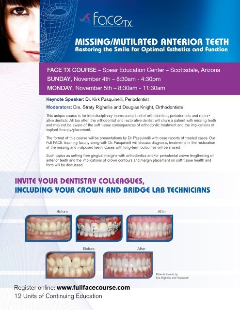 Missing/Mutilated anterior teeth - Roth Williams International Society ...