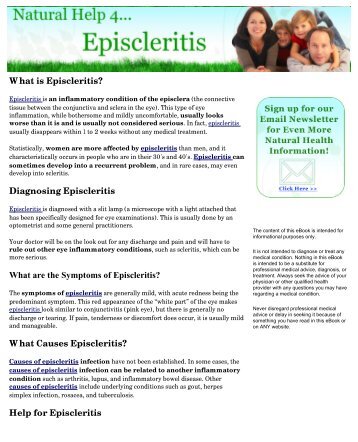 Natural Help for Episcleritis - Abbys Good Stuff