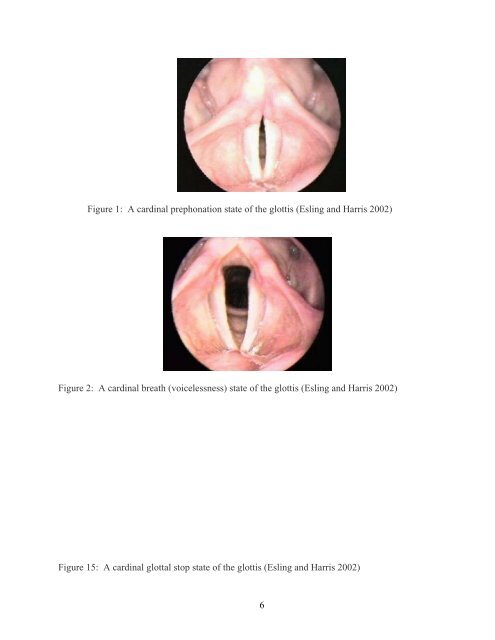 1 A phonetic study of the Sui consonants and tones Jerold A ...