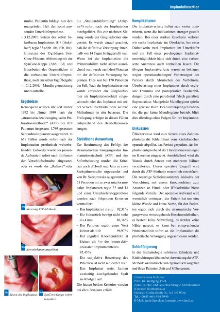 Die atraumatische transgingivale Perforation (ATP)