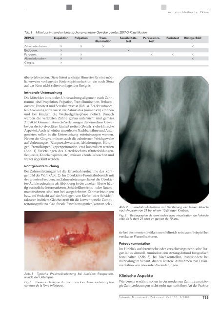 Avulsion bleibender Zähne: Diagnostische, klinische und ... - SSO