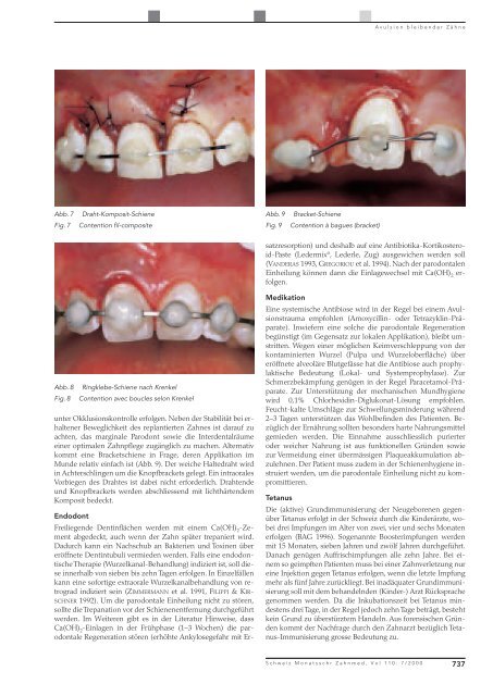 Avulsion bleibender Zähne: Diagnostische, klinische und ... - SSO