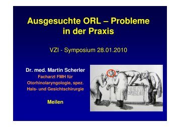 ORL Probleme in der Praxis - Vereinigung Zuercher Internisten