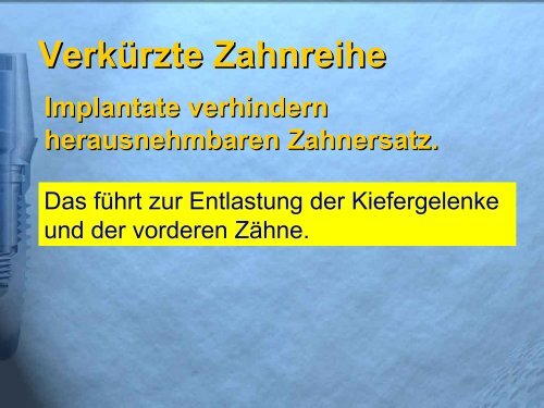 Ihre Zähne im Blickpunkt - Mehr Lebensqualität durch Zahnimplantate