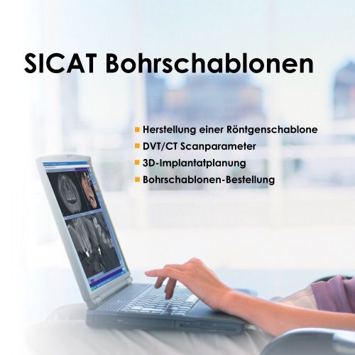 SICAT Bohrschablonen