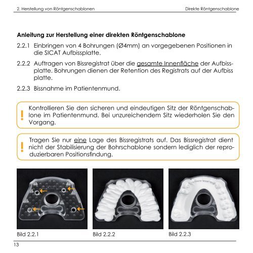 SICAT Bohrschablonen