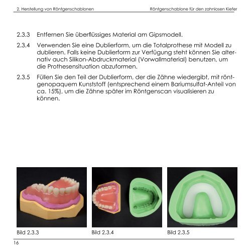 SICAT Bohrschablonen