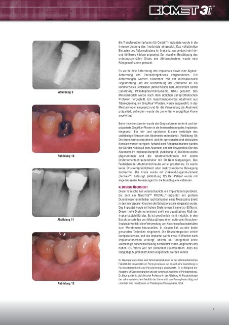 NanoTite-Implantate: Zahnimplantate der nächsten ... - BIOMET 3i